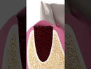 Esponja absorbente de colágeno 100 % puro GDT Hemosponge