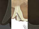 MAX - Basal/Cortical Spiral Implant, Internal Hex