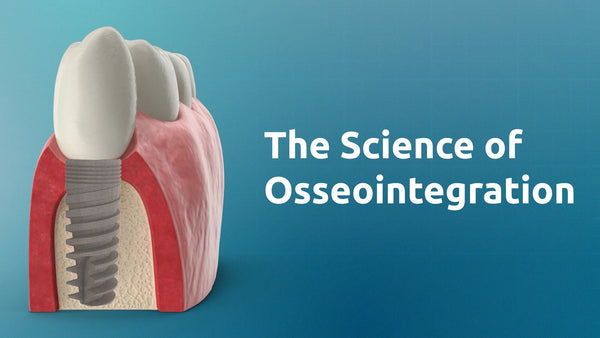 The Science of Osseointegration: How Dental Implants Bond with Bone