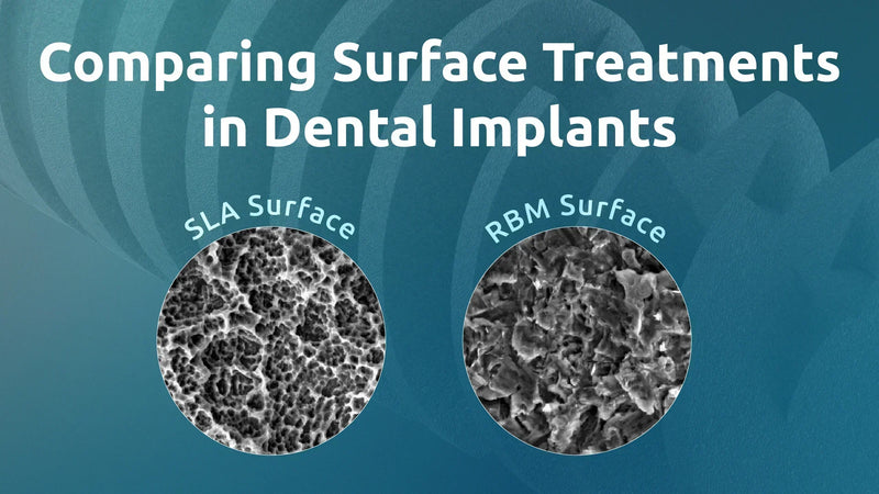 Comparing Surface Treatments in Dental Implants: SLA, RBM, and Beyond