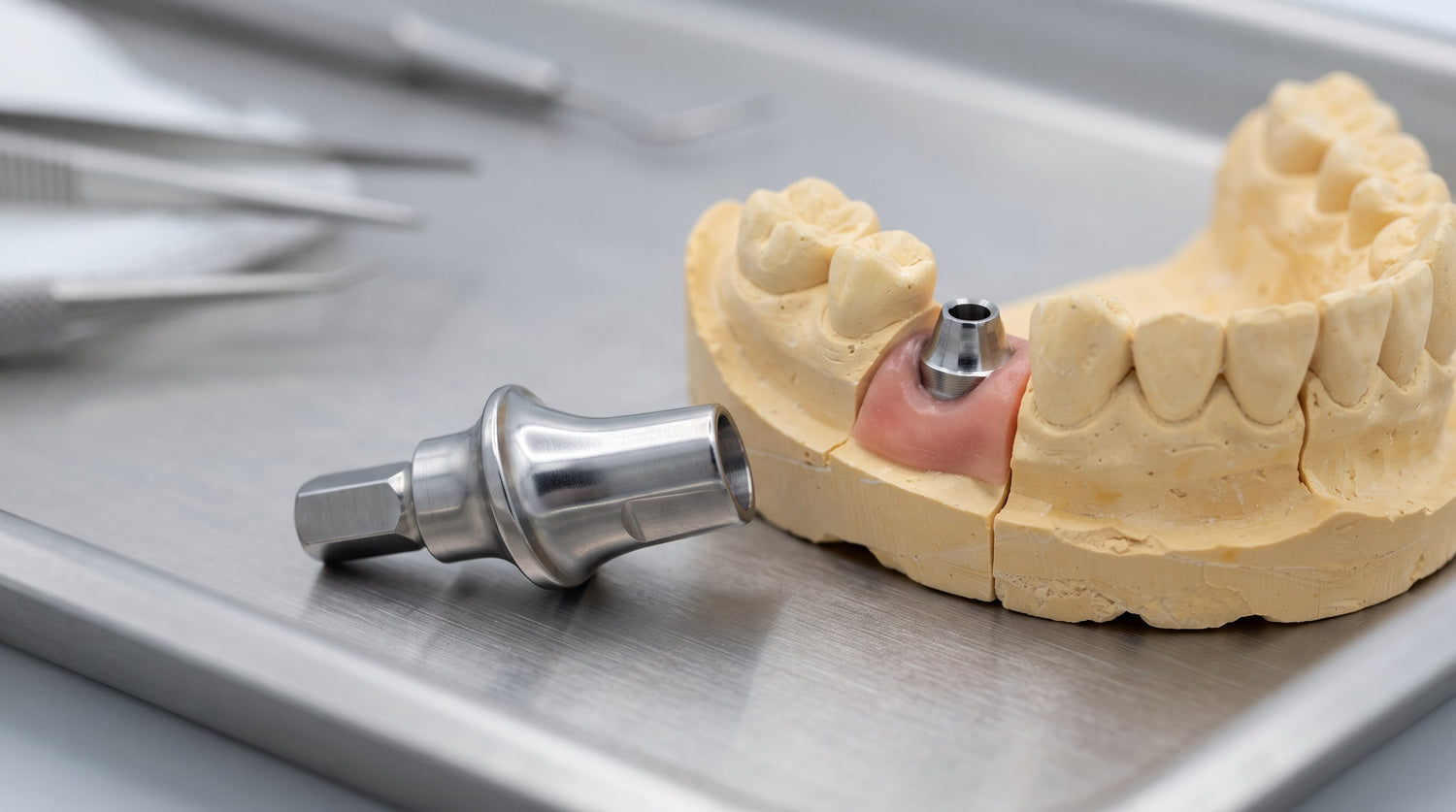 What Is a Custom Abutment for an Implant