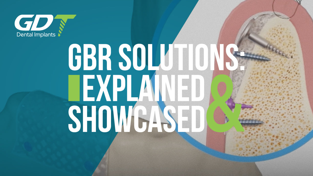 Understanding Guided Bone Regeneration (GBR): Explanation & Product Sh