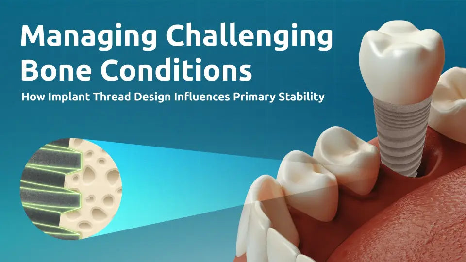 Managing Challenging Bone Conditions: How Implant Thread Design Influences Primary Stability