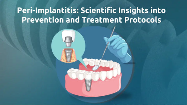 Peri-Implantitis: Scientific Insights into Prevention and Treatment Protocols