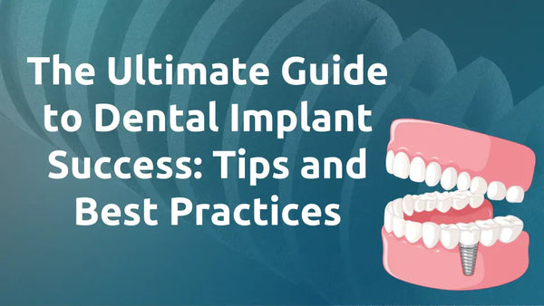 The Ultimate Guide to Dental Implant Success: Tips and Best Practices