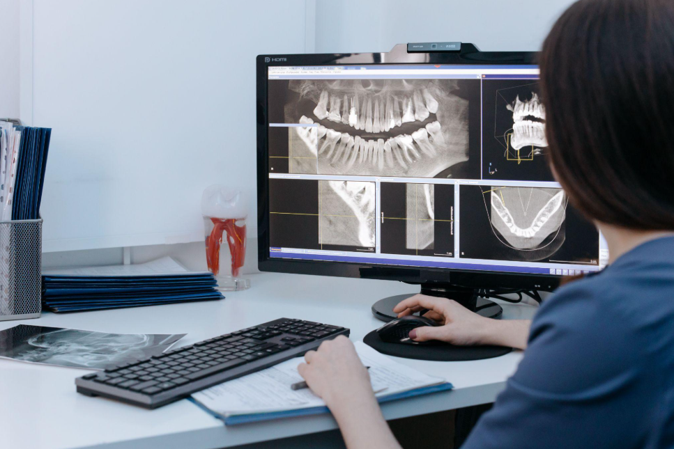 how to check primary stability of implant