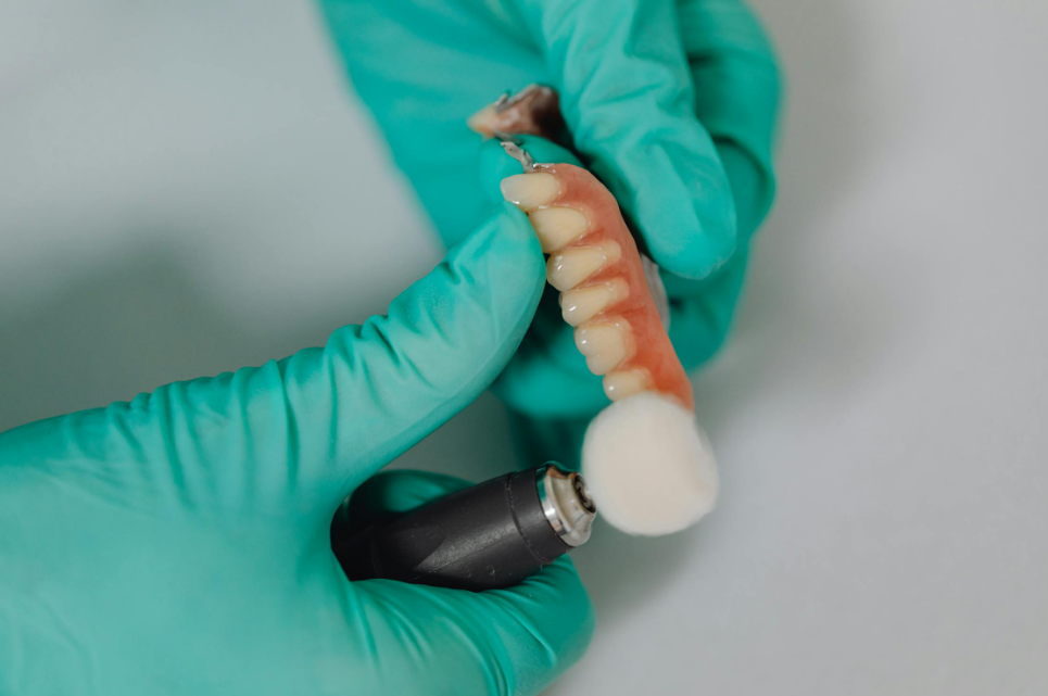 Dental Implant Failure Management