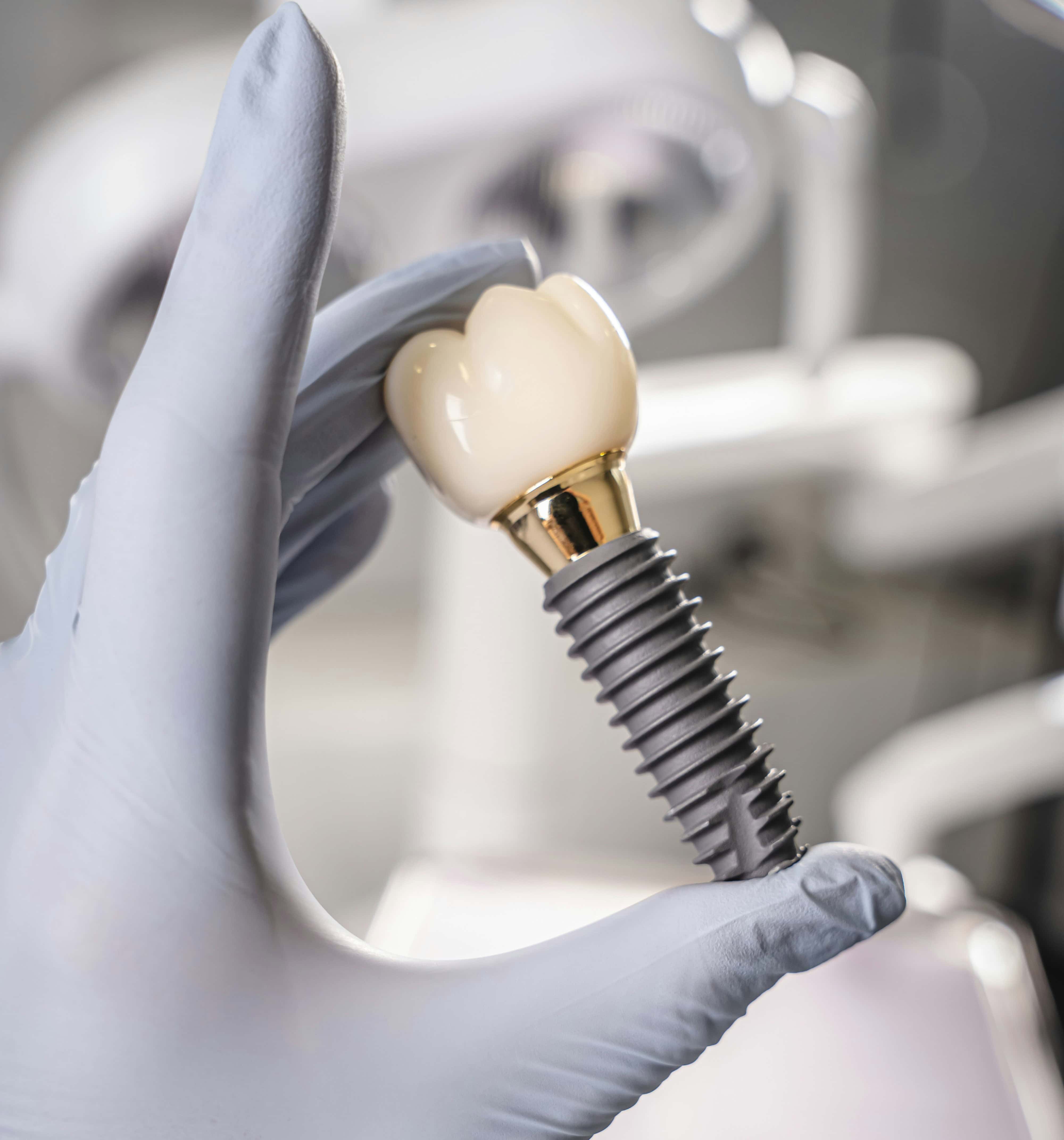 Dental Implant Size Chart Easy Understanding