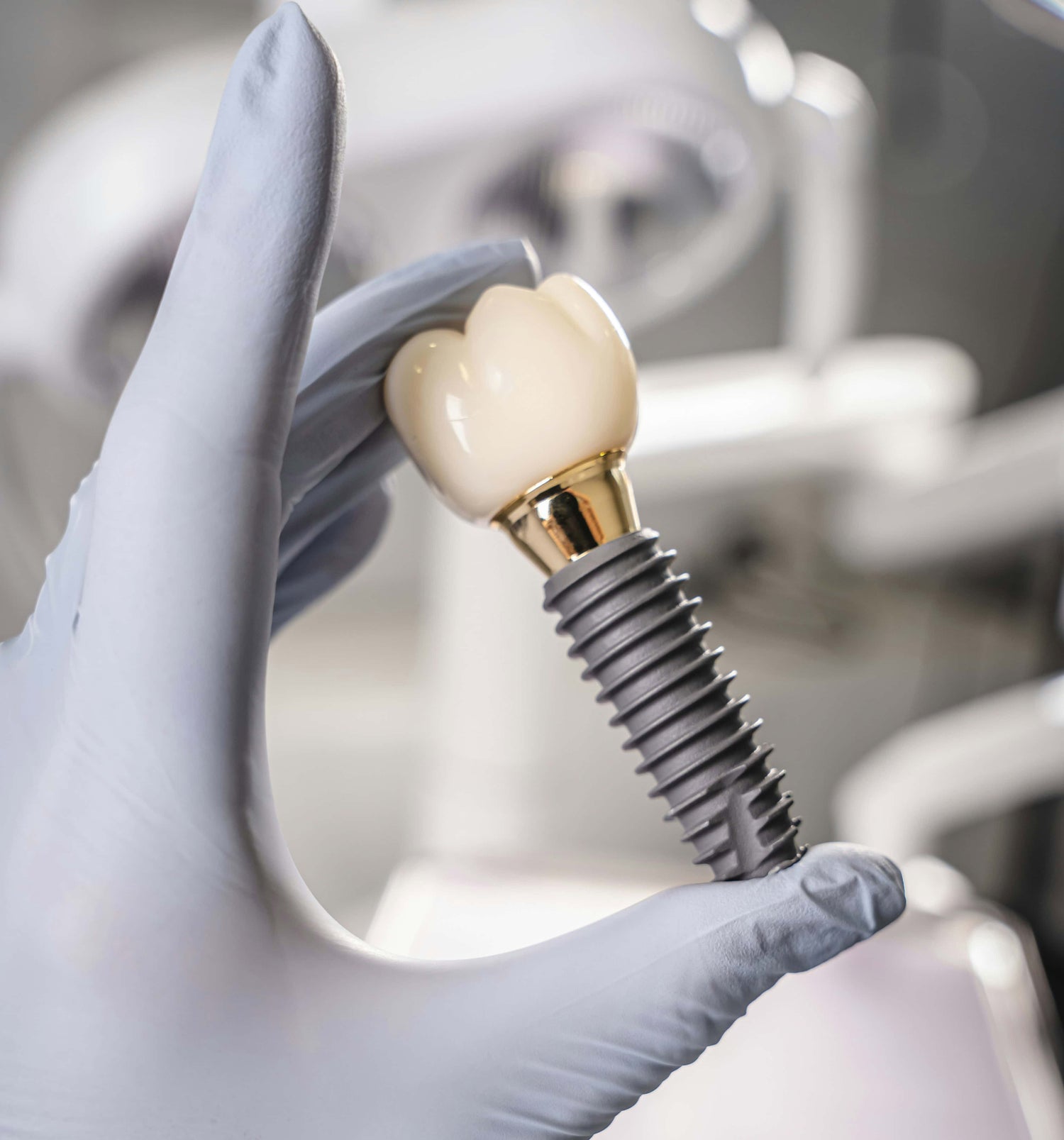 Dental Implant Size Chart