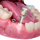 Hex Driver with Built-in Light For Implants 2.42mm & Prosthetics 1.25mm