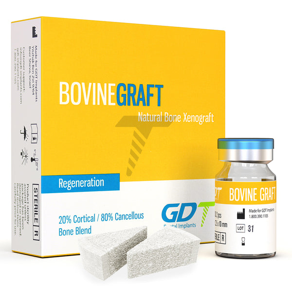 Bovine Bone Graft - Cones