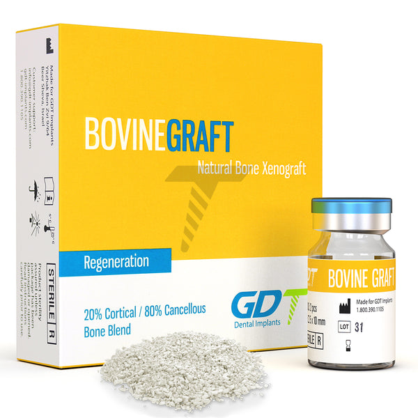 Bovine Bone Graft - Granules